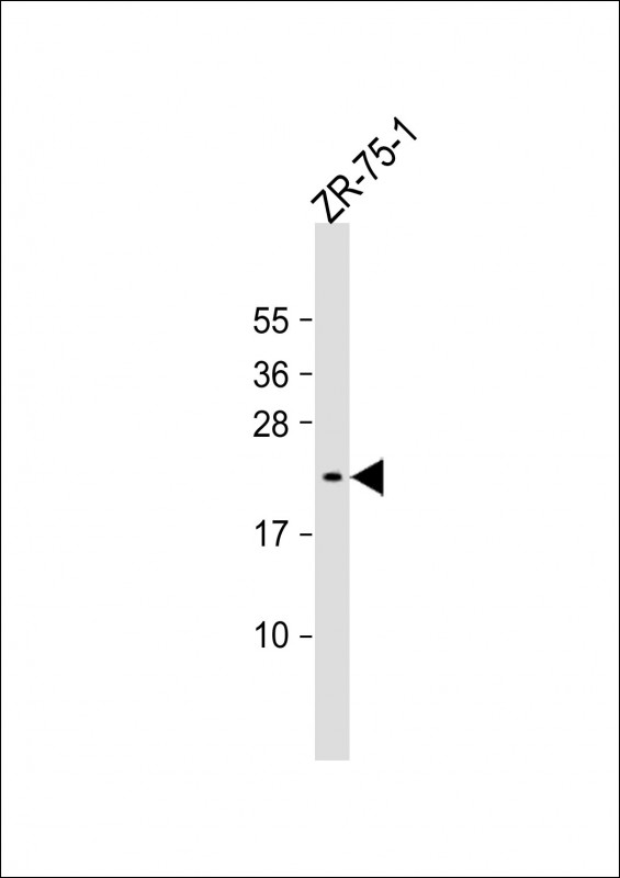 Rabbit Polyclonal Antibody to AVP