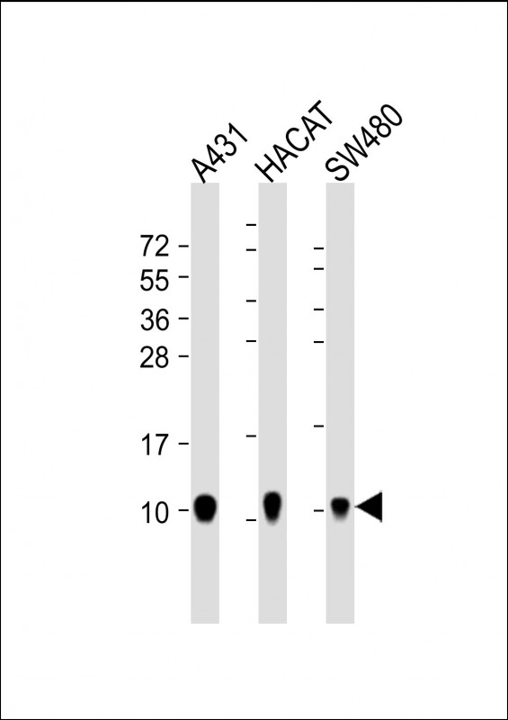Mouse Monoclonal Antibody to S100A2