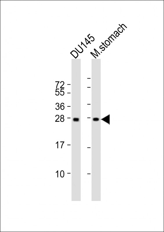 Mouse Monoclonal Antibody to RAB27B