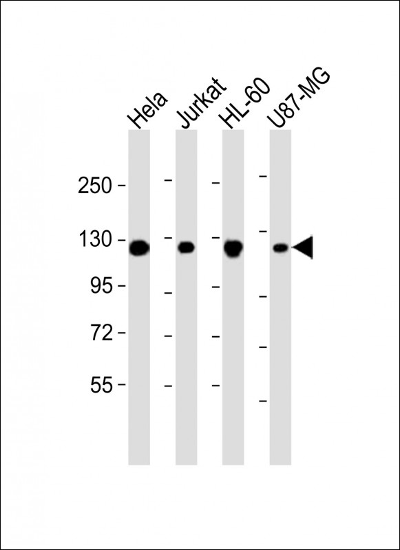 Mouse Monoclonal Antibody to RNF20