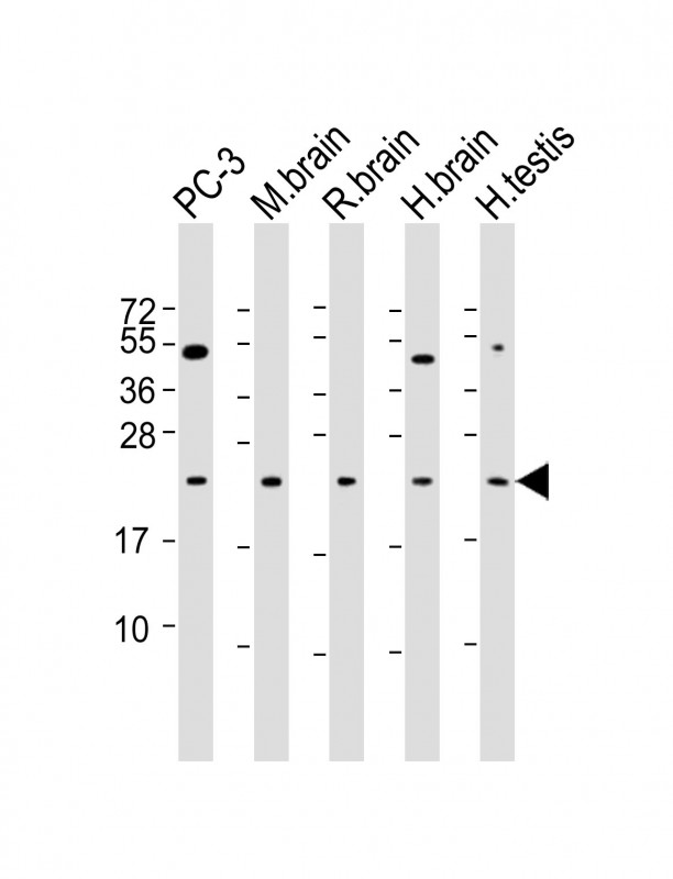 Mouse Monoclonal Antibody to RAB18