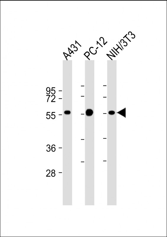 Mouse Monoclonal Antibody to MITF