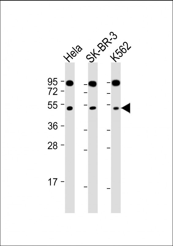 Rabbit Polyclonal Antibody to SLC16A13
