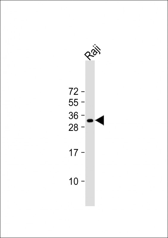 Rabbit Polyclonal Antibody to HLA-DQA1 (N-term)