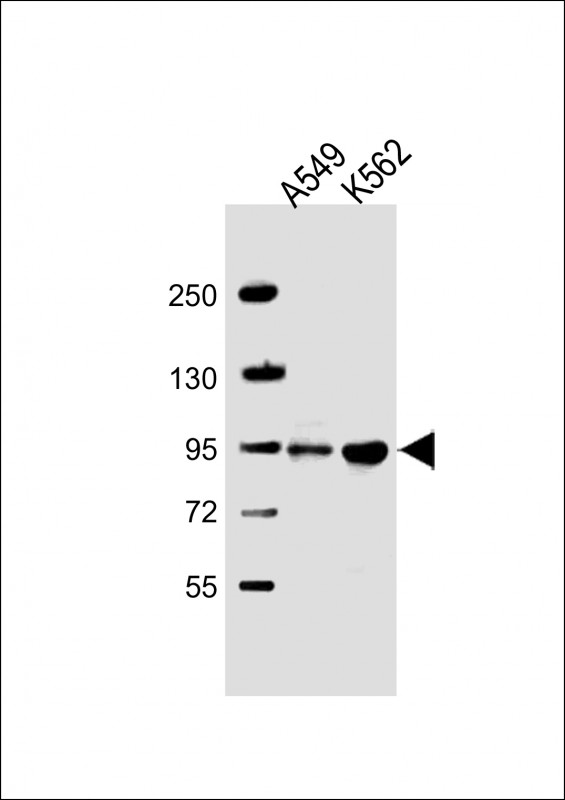 Rabbit Polyclonal Antibody to SH3D20