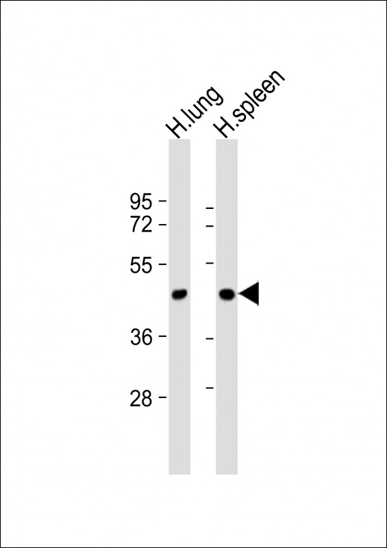 Rabbit Polyclonal Antibody to LOXL3