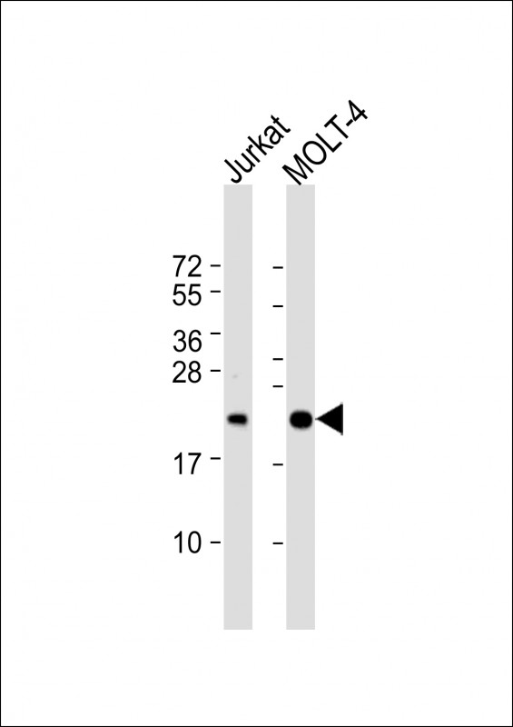 Rabbit Polyclonal Antibody to CD3Z (N-term)