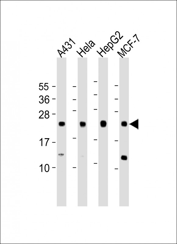 Rabbit Polyclonal Antibody to LITAF (N-Term)