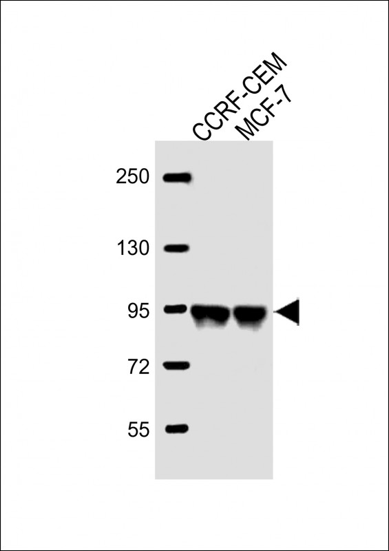 Rabbit Polyclonal Antibody to AFTPH