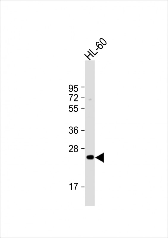 Rabbit Polyclonal Antibody to MMP7