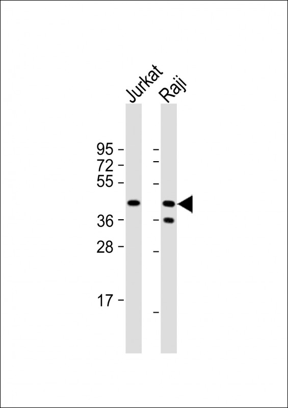 Rabbit Polyclonal Antibody to CD82 (ST6)