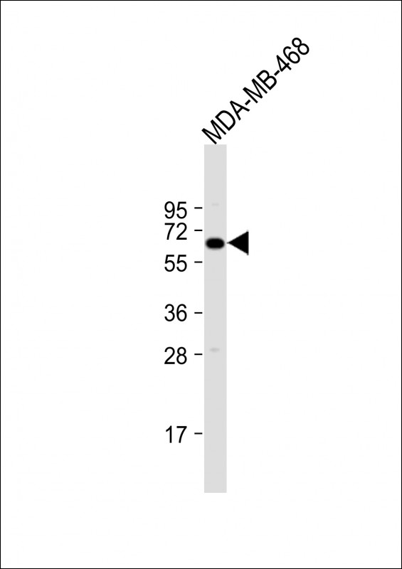 Rabbit Polyclonal Antibody to YES1 (N-term)