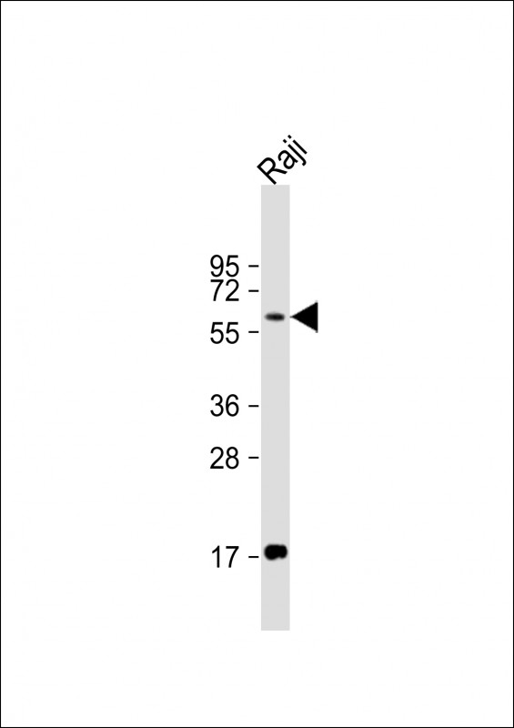 Rabbit Polyclonal Antibody to RIPK2