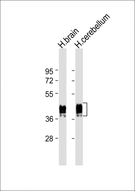 Mouse Monoclonal Antibody to GFAP