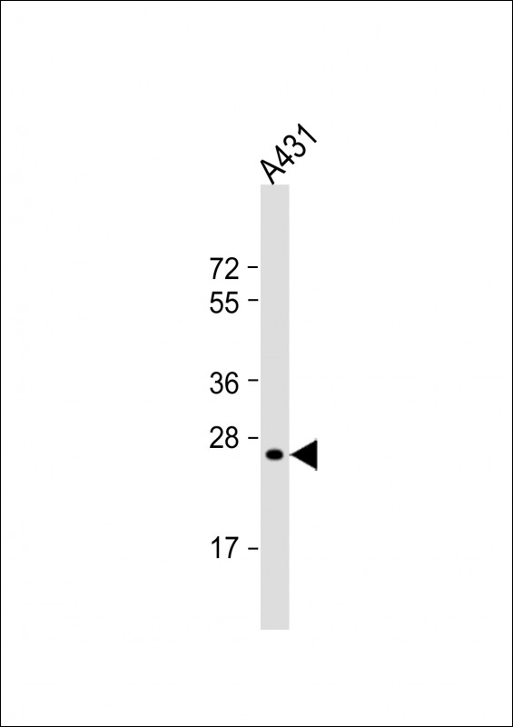 Mouse Monoclonal Antibody to RAB5B