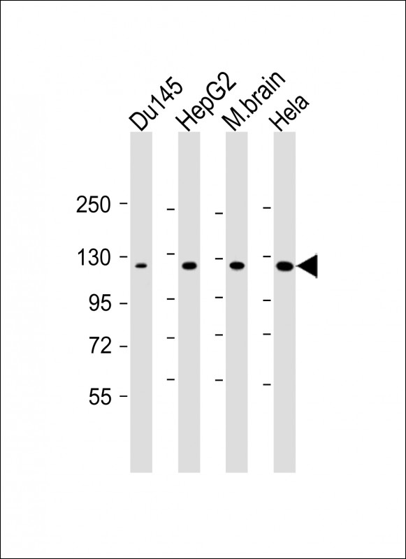 Mouse Monoclonal Antibody to DAB2IP