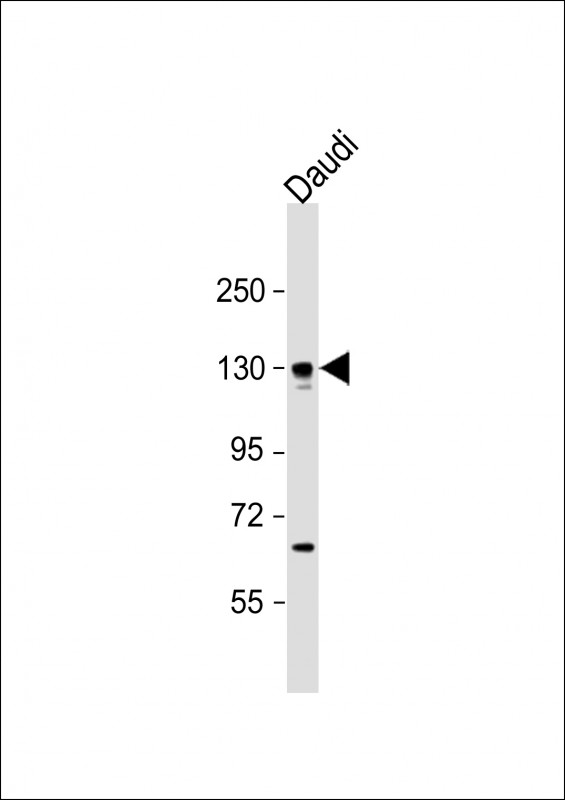 Rabbit Polyclonal Antibody to BACH2