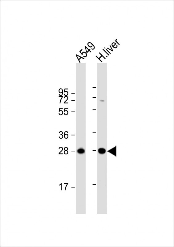 Rabbit Polyclonal Antibody to NNMT