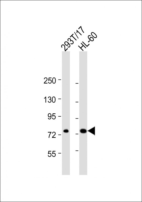 Rabbit Polyclonal Antibody to ABCD1