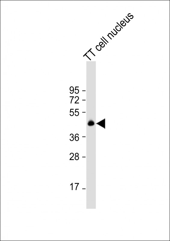 Rabbit Polyclonal Antibody to NKX2-1 (N-term)