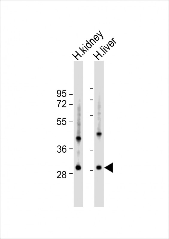 Rabbit Polyclonal Antibody to U119B  (C-term)
