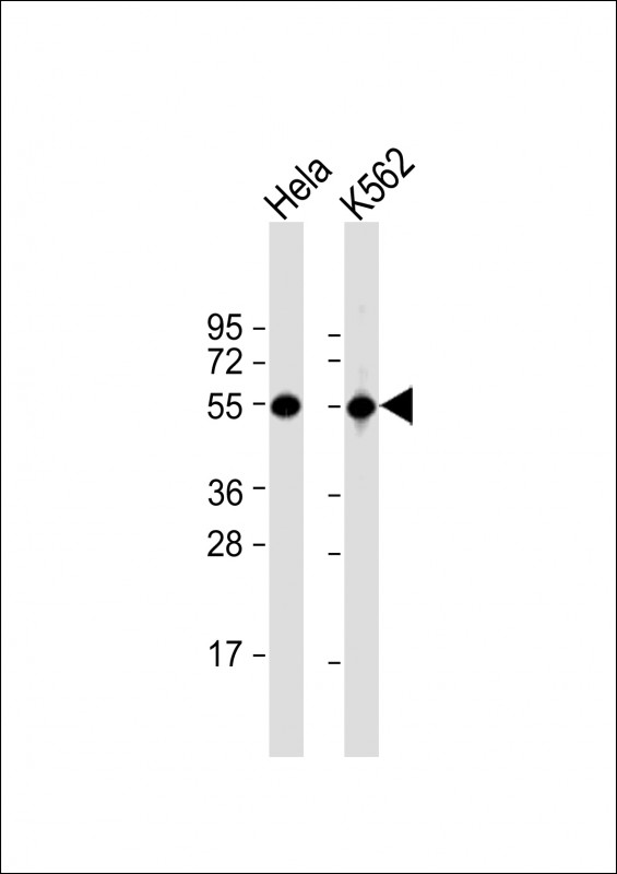 Rabbit Polyclonal Antibody to ATP6V1B1