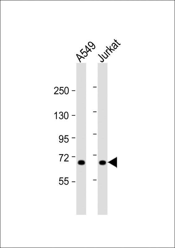 Rabbit Polyclonal Antibody to F11