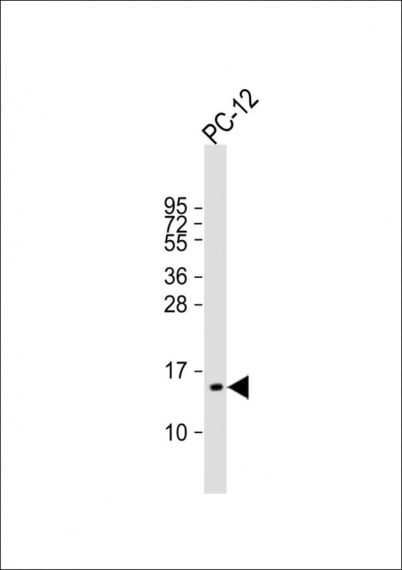 Rabbit Polyclonal Antibody to ID1