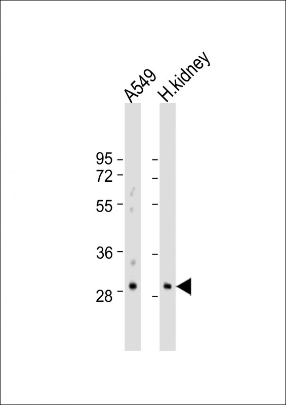 Rabbit Polyclonal Antibody to PABPN1L
