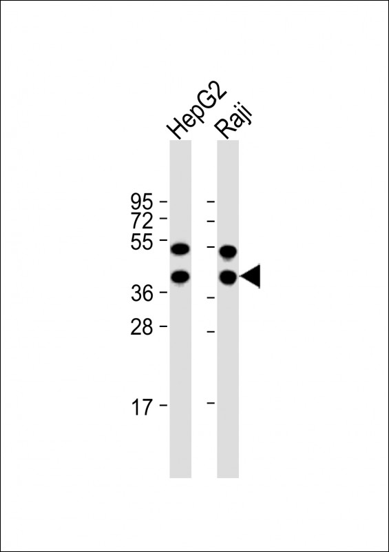 Rabbit Polyclonal Antibody to TXNL2 (N-term)