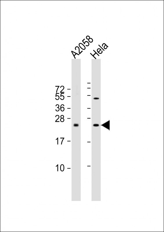 Rabbit Polyclonal Antibody to SDHD (N-term)