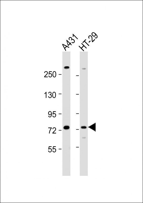 Rabbit Polyclonal Antibody to PAK6