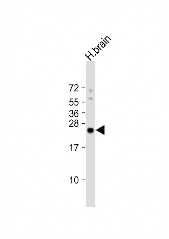 Rabbit Polyclonal Antibody to ARHB