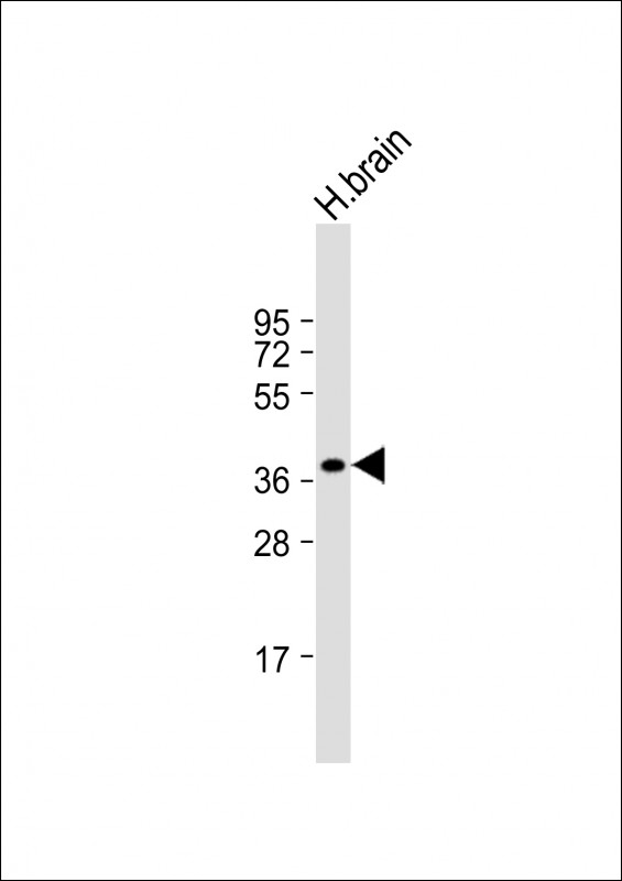 Rabbit Polyclonal Antibody to CEACAM18 (N-term)