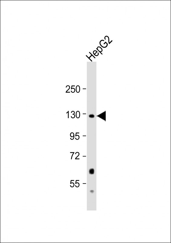 Rabbit Polyclonal Antibody to PC (N-term)
