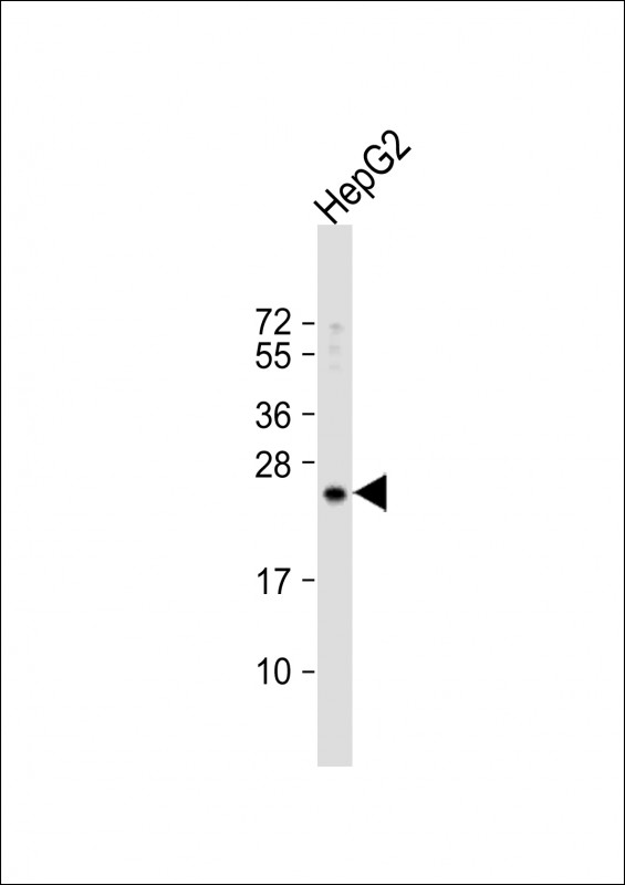 Rabbit Polyclonal Antibody to RPL15 (N-term)