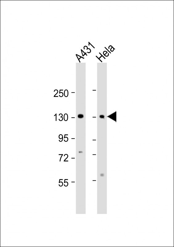 Rabbit Polyclonal Antibody to ZBTB11