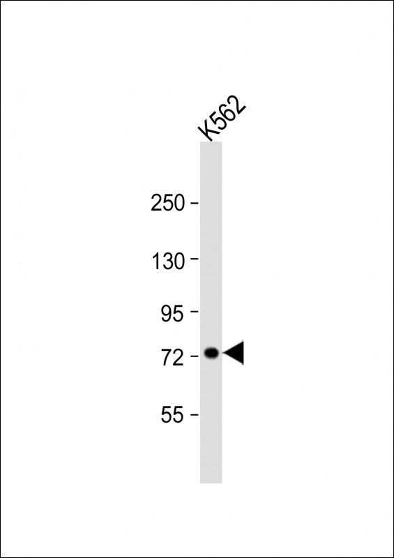 Rabbit Polyclonal Antibody to UMOD