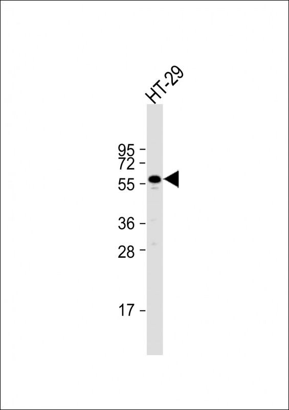 Rabbit Polyclonal Antibody to RIPK3