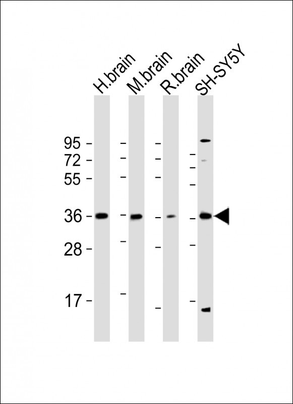 Rabbit Polyclonal Antibody to Connexin 36