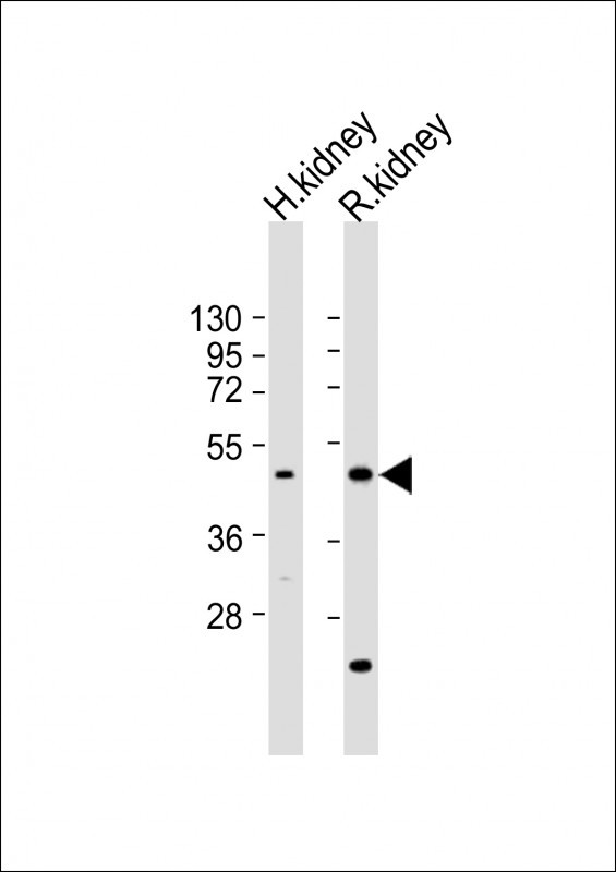 Rabbit Polyclonal Antibody to KCNK12