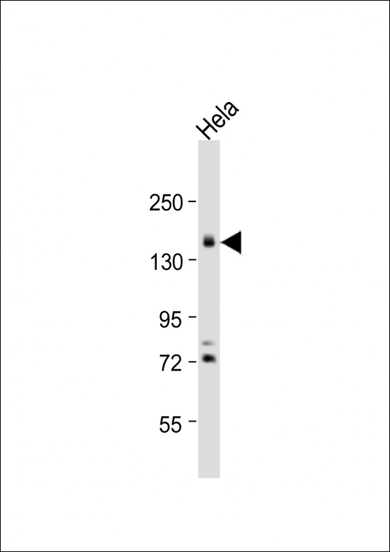 Rabbit Polyclonal Antibody to PODXL
