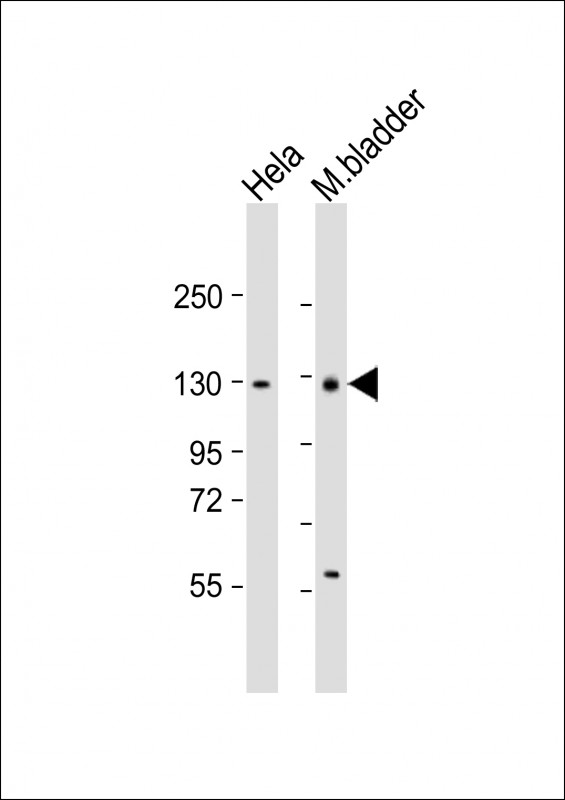 Rabbit Polyclonal Antibody to Mouse Enpp1 (N-term)