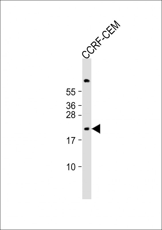 Rabbit Polyclonal Antibody to FXN (N-term)