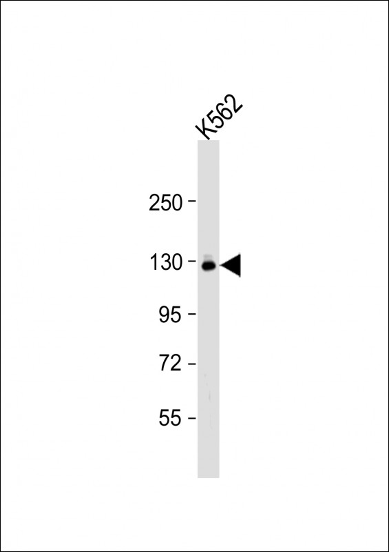 Rabbit Polyclonal Antibody to UBE4A
