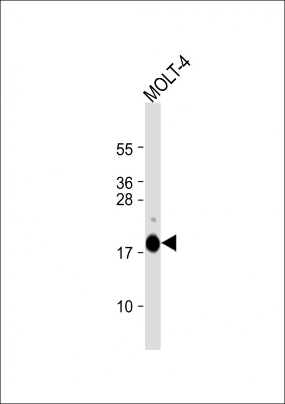Rabbit Polyclonal Antibody to UBE2L6