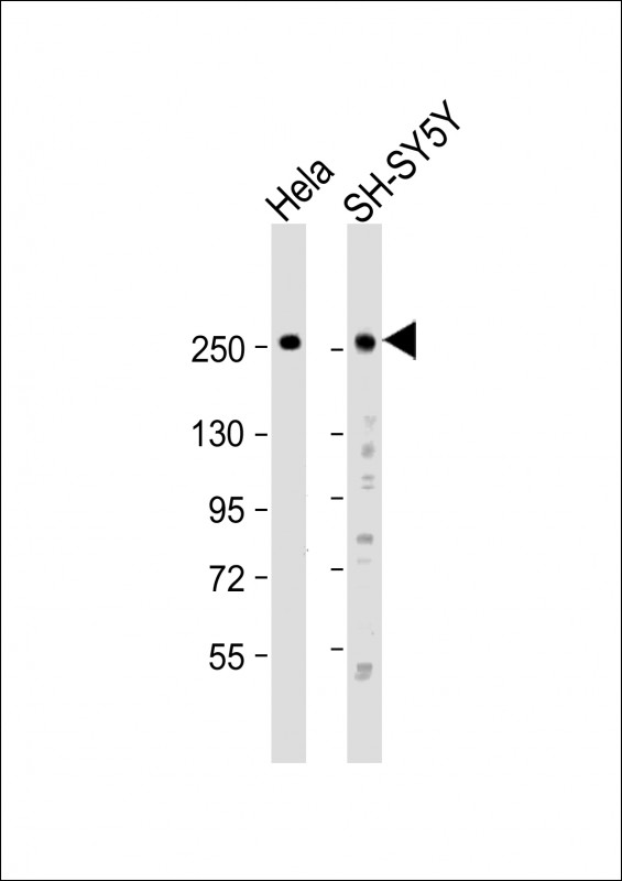 Rabbit Polyclonal Antibody to ROBO1