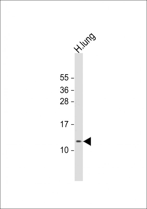 Rabbit Polyclonal Antibody to RIG