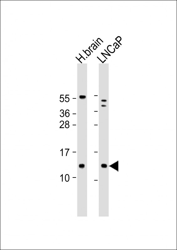 Rabbit Polyclonal Antibody to C18orf32