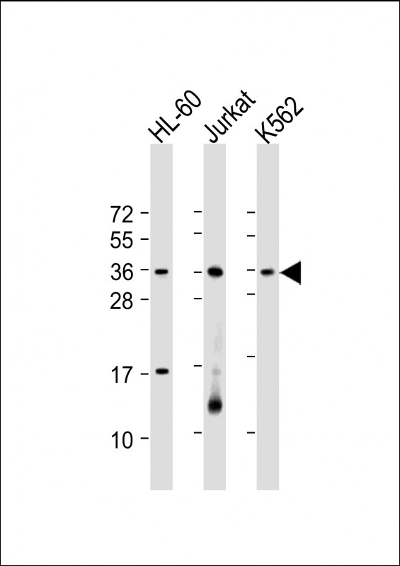 Rabbit Polyclonal Antibody to RSPO1